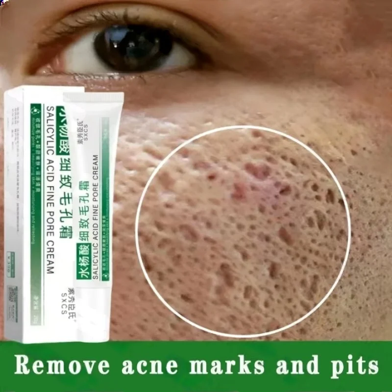 Salicylsäure Poren Clearing Cr – Korean Skincare Routine Bewertung und Preis